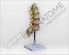Coluna Vertebral Lombar